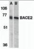 Western blot analysis of BACE2 in (A) human and (B) mouse heart tissue lysates with BACE2 antibody at 1 &#956;g/mL.