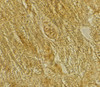 Immunohistochemistry of BACE2 in rat heart tissue with BACE2 antibody at 2 ug/mL.