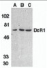 Western blot analysis of DcR1 in HeLa cell (A) , mouse (B) and rat (C) liver tissue lysates with DcR1 antibody at 1 &#956;g/mL.