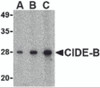 Western blot analysis of CIDE-B in mouse small intestine tissue lysate with CIDE-B antibody at (A) 0.5, (B) 1 and (C) 2 &#956;g/mL.