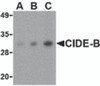 Western blot analysis of CIDE-B in mouse small intestine tissue lysate with CIDE-B antibody at (A) 0.5, (B) 1 and (C) 2 μg/mL.