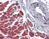 Immunohistochemistry of caspase-12 in human heart tissue with caspase-12 antibody at 10 ug/mL.