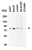 Figure 2 Western Blot Validation in Human and Mouse Cell Lines
Loading: 15 ug of lysates per lane.
Antibodies: IKK epsilon 2329 (1 ug/mL) , 1h incubation at RT in 5% NFDM/TBST.
Secondary: Goat anti-rabbit IgG HRP conjugate at 1:10000 dilution.