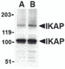 Western blot analysis of IKAP in A-20 cell lysate with IKAP antibody at in (A) 0.5, and (B) 1 &#956;g/mL.