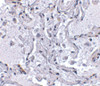 Immunohistochemical staining of human lung tissue using TP1 antibody at 2.5 ug/mL.