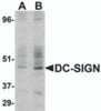 Western blot detection of DC-SIGN in human small intestine at (A) 1 and (B) 2 &#956;g/ml.