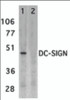 Western blot analysis of DC-SIGN expression in human placenta tissue lysate in the absence (lane 1) and presence (lane 2) of blocking peptide with DC-SIGN antibody at 2 &#956;g/ml.