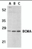 Western blot analysis of BCMA in (A) human spleen tissue lysate, (B) K562, and (C) U937 cell lysates with BCMA antibody at 5 &#956;g/mL.