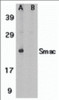 Figure 1 Western Blot Validation in Human Heart Tissue Lysate
Loading: 15 &#956;g of lysates per lane.
Antibodies: Smac 2409 (1 &#956;g/mL) , 1h incubation at RT in 5% NFDM/TBST.
Secondary: Goat anti-rabbit IgG HRP conjugate at 1:10000 dilution.
 (A) Without blocking peptide
 (B) With blocking peptide