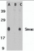 Figure 1 Western Blot Validation in (A and B) Mouse Heart Tissue Lysate and (C) Rat Heart Tissue Lysate 
Loading: 15 &#956;g of lysates per lane.
Antibodies: Smac 2411 (1 &#956;g/mL) , 1h incubation at RT in 5% NFDM/TBST.
Secondary: Goat anti-rabbit IgG HRP conjugate at 1:10000 dilution.
A Mouse heart
B Mouse heart and blocking peptide
C Rat heart