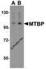 Western blot analysis of MTBP expression in K562 cell lysate with MTBP antibody at (A) 1 and (B) 2 &#956;g/ml.