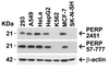 Figure 1 Independent Antibody Validation (IAV) via Protein Expression Profile in Human Cell Lines
Loading: 15 &#956;g of lysates per lane.
Antibodies: PERP 2451 (1 &#956;g/mL) , PERP, 57-777 (2 &#956;g/mL) , beta-actin 3779 (1 &#956;g/mL) and GAPDH (0.02 &#956;g/mL) , 1h incubation at RT in 5% NFDM/TBST.
Secondary: Goat anti-rabbit IgG HRP conjugate at 1:10000 dilution.