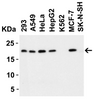 Figure 2 Western Blot Validation in Human Cell Lines
Loading: 15 ug of lysates per lane.
Antibodies: PERP 2451 (1 ug/mL) , 1h incubation at RT in 5% NFDM/TBST.
Secondary: Goat anti-rabbit IgG HRP conjugate at 1:10000 dilution.