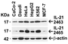 Figure 2 Independent Antibody Validation (IAV) via Protein Expression Profile in Cell Lines
Loading: 15 ug of lysates per lane.
Antibodies: IL-21 2465 (1 ug/mL) , IL-21 2463 (5 ug/mL) , beta-actin (5 ug/mL) and beta-actin (1 ug/mL) , 1h incubation at RT in 5% NFDM/TBST.
Secondary: Goat anti-rabbit IgG HRP conjugate at 1:10000 dilution.