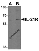Western blot analysis of IL-21 receptor expression in human HepG2 cell lysate with IL-21 receptor antibody at (A) 1 and (B) 2 &#956;g/ml.