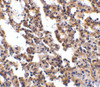 Immunohistochemistry of IL-21 receptor in rat lung with IL-21 receptor antibody at 10 ug/mL.