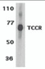 Western blot analysis of TCCR expression in human spleen tissue lysates with TCCR antibody at 1 &#956;g/ml.