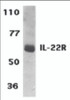 Western blot analysis of IL-22 Receptor expression in human HepG2 cell lysate with IL-22 Receptor antibody at 1 &#956;g/ml.