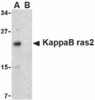 Western blot analysis of KappaB ras2 in RAW264.7 cell lysate with KappaB ras2 antibody at 1 &#956;g/mL in the (A) absence and (B) presence of blocking peptide.