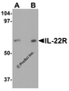 Western blot analysis of IL-22 receptor expression in human HepG2 cell lysate with IL-22 receptor antibody at (A) 0.5 and (B) 1 &#956;g/ml.