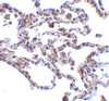 Immunohistochemistry of CIKS in human lung tissue with CIKS antibody at 5 ug/mL.