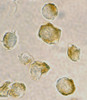 Immunocytochemistry of Nudel in Jurkat cells with Nudel antibody at 2 ug/mL.