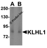 Western blot analysis of KLHL1 in HeLa cell lysate with KLHL1 antibody at (A) 2 and (B) 4 &#956;g/mL.