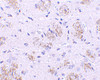 Immunohistochemistry of KLHL1 in rat brain tissue with KLHL1 antibody at 10 ug/mL.