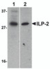 Western blot analysis of ILP-2 expression in human HepG2 (lane 1) and MOLT4 (lane 2) cell lysates with ILP-2 antibody at 1 &#956;g/mL.
