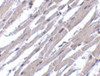 Immunohistochemistry of Bcl-rambo in human heart tissue with Bcl-rambo antibody at 10 ug/mL.