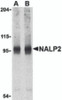 Western blot analysis of NALP2 in PC-3 cell lysate with NALP2 antibody at (A) 1 and (B) 2 &#956;g/mL.