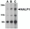 Western blot analysis of NALP1 in U937 cell lysate with NALP1 antibody at (A) 1, (B) 2 and (C) 4 &#956;g/mL.