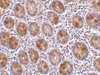 Immunohistochemistry of AATF in human small intestine tissue with AATF antibody at 10 ug/mL.