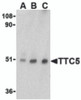 Western blot analysis of TTC5 in RAW264.7 cell lysate with TTC5 antibody at (A) 0.5, (B) 1 and (C) 2 &#956;g/mL.