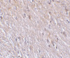 Immunohistochemistry of TTC5 in mouse brain tissue with TTC5 antibody at 10 ug/mL.