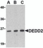 Western blot analysis of DEDD2 in RAW264.7 cell lysate with DEDD2 antibody at (A) 0.5, (B) 1 and (C) 2 &#956;g/mL.
