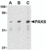 Western blot analysis of PAK6 in Raji lysate with PAK6 antibody at (A) 1, (B) 2, and (C) 4 &#956;g/mL.
