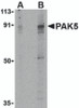 Western blot analysis of PAK5 in T24 lysate with PAK5 antibody at (A) 2 and (B) 4 &#956;g/mL.