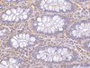 Immunohistochemistry of PAK4 in human colon tissue with PAK4 antibody at 10 ug/mL.