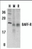 Western blot analysis of BAFF Receptor in human (H) , mouse (M) , and rat (R) spleen tissue lysates with BAFF Receptor antibody at 5 &#956;g/mL.