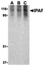 Western blot analysis of Ipaf in human PBL lysate with Ipaf antibody at 0.5 (lane A) , 1 (lane B) , and 2 (lane C) &#956;g/mL, respectively.