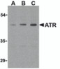 Western blot analysis of ATR in HepG2 cell lysates with ATR antibody (IN) at (A) 0.5, (B) 1, and (C) 2 &#956;g/mL.