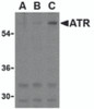 Western blot analysis of ATR in K562 cell lysates with ATR antibody at (A) 0.5, (B) 1, and (C) 2 &#956;g/mL.