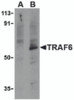 Western blot analysis of TRAF6 in PC-3 cell lysates with TRAF6 antibody at 1 &#956;g/mL in the presence (A) or absence (B) of 1 &#956;g blocking peptide.