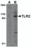 Western blot analysis of TLR2 in A20 cell lysates with TLR2 antibody at 1 &#956;g/mL in the presence (A) and absence (B) of its blocking peptide.