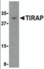Western blot analysis of TIRAP in MCF-7 cell lysate with TIRAP antibody at 4 &#956;g/mL.