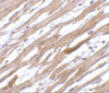 Immunohistochemistry of TIRAP in human heart tissue with TIRAP antibody at 20 ug/mL.