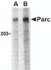 Western blot analysis of PARC in Daudi lysate with PARC antibody at (A) 1 and (B) 2 &#956;g/mL.