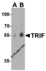 Western blot analysis of TRIF in human lung lysate with TRIF antibody at (A) 1 and (B) 2 &#956;g/mL.