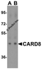 Western blot analysis of CARD8 expression in human lung tissue lysate with CARD8 antibody at (A) 1 and (B) 2 &#956;g/ml.